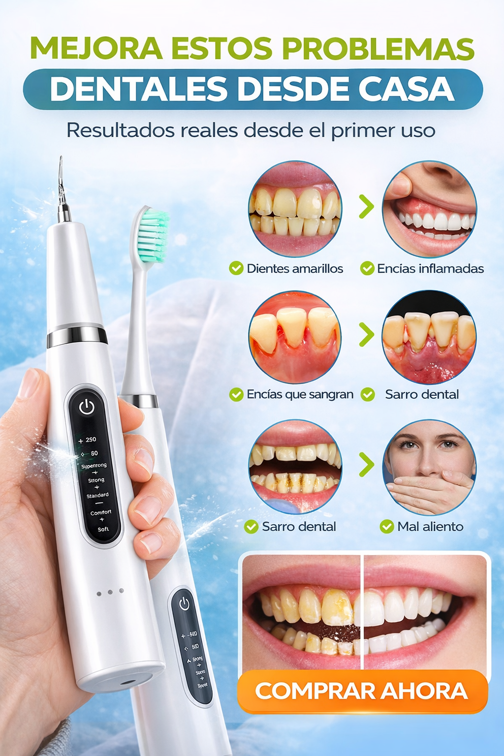 SonrisaPro™ - Limpieza dental profesional en casa